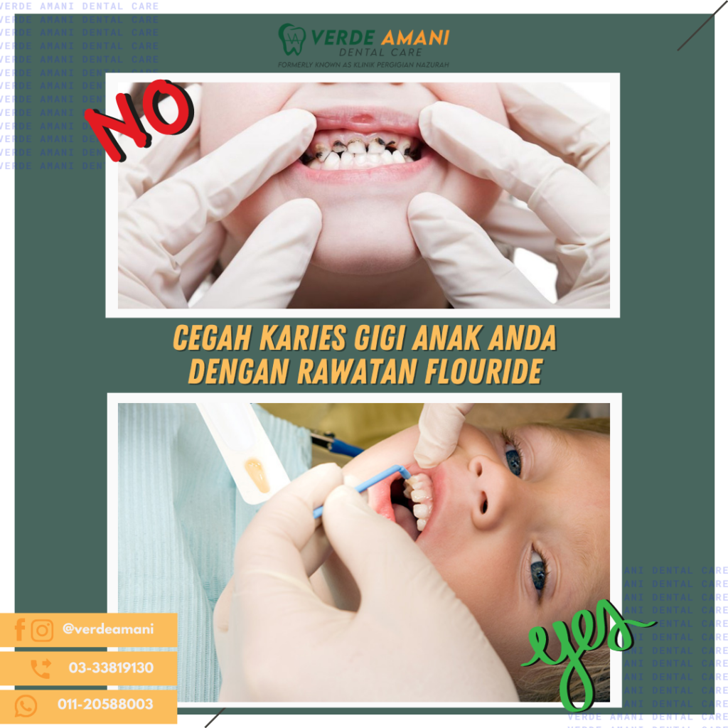 harga cabut gigi di klinik swasta 