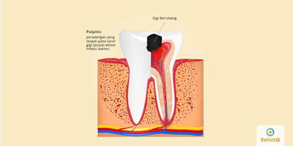 harga cabut gigi di klinik swasta 